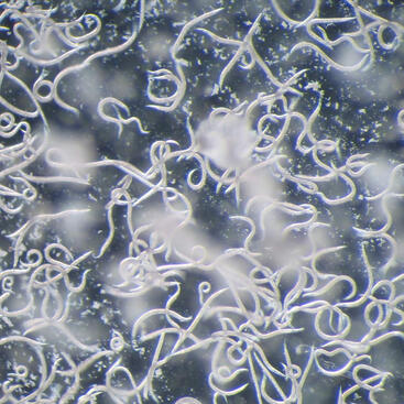 Microscopic view of numerous insect-parasitic nematodes used in UCR research on biological pest control and crop protection.